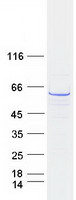 Coomassie blue staining of purified CCT3 protein (Cat# TP303580). The protein was produced from HEK293T cells transfected with CCT3 cDNA clone (Cat# RC203580) using MegaTran 2.0 (Cat# TT210002).