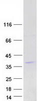 Coomassie blue staining of purified R3HDM4 protein (Cat# TP303619). The protein was produced from HEK293T cells transfected with R3HDM4 cDNA clone (Cat# RC203619) using MegaTran 2.0 (Cat# TT210002).