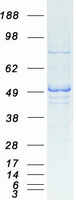 Coomassie blue staining of purified ARMT1 protein (Cat# TP303695). The protein was produced from HEK293T cells transfected with ARMT1 cDNA clone (Cat# RC203695) using MegaTran 2.0 (Cat# TT210002).