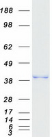 Coomassie blue staining of purified MGME1 protein (Cat# TP303886). The protein was produced from HEK293T cells transfected with MGME1 cDNA clone (Cat# RC203886) using MegaTran 2.0 (Cat# TT210002).