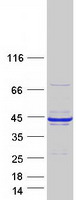 Coomassie blue staining of purified RCN1 protein (Cat# TP303990). The protein was produced from HEK293T cells transfected with RCN1 cDNA clone (Cat# RC203990) using MegaTran 2.0 (Cat# TT210002).