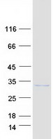 Coomassie blue staining of purified SLC66A2 protein (Cat# TP304310). The protein was produced from HEK293T cells transfected with SLC66A2 cDNA clone (Cat# RC204310) using MegaTran 2.0 (Cat# TT210002).