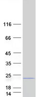 Coomassie blue staining of purified MRPL17 protein (Cat# TP304395). The protein was produced from HEK293T cells transfected with MRPL17 cDNA clone (Cat# RC204395) using MegaTran 2.0 (Cat# TT210002).