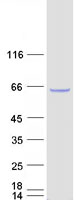 Coomassie blue staining of purified CDKN2AIP protein (Cat# TP304658). The protein was produced from HEK293T cells transfected with CDKN2AIP cDNA clone (Cat# RC204658) using MegaTran 2.0 (Cat# TT210002).