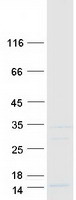 Coomassie blue staining of purified SS18L2 protein (Cat# TP304667). The protein was produced from HEK293T cells transfected with SS18L2 cDNA clone (Cat# RC204667) using MegaTran 2.0 (Cat# TT210002).