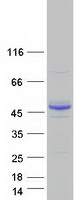 Coomassie blue staining of purified ALG2 protein (Cat# TP304766). The protein was produced from HEK293T cells transfected with ALG2 cDNA clone (Cat# RC204766) using MegaTran 2.0 (Cat# TT210002).