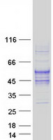 Coomassie blue staining of purified TMIGD2 protein (Cat# TP304938). The protein was produced from HEK293T cells transfected with TMIGD2 cDNA clone (Cat# RC204938) using MegaTran 2.0 (Cat# TT210002).
