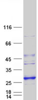 Coomassie blue staining of purified LYPLAL1 protein (Cat# TP304998). The protein was produced from HEK293T cells transfected with LYPLAL1 cDNA clone (Cat# RC204998) using MegaTran 2.0 (Cat# TT210002).