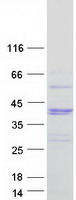 Coomassie blue staining of purified WBP2NL protein (Cat# TP305495). The protein was produced from HEK293T cells transfected with WBP2NL cDNA clone (Cat# RC205495) using MegaTran 2.0 (Cat# TT210002).
