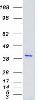 Coomassie blue staining of purified MAP2K4 protein (Cat# TP306051). The protein was produced from HEK293T cells transfected with MAP2K4 cDNA clone (Cat# RC206051) using MegaTran 2.0 (Cat# TT210002).