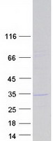 Coomassie blue staining of purified KCTD21 protein (Cat# TP306177). The protein was produced from HEK293T cells transfected with KCTD21 cDNA clone (Cat# RC206177) using MegaTran 2.0 (Cat# TT210002).