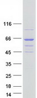 Coomassie blue staining of purified DENND6B protein (Cat# TP306245). The protein was produced from HEK293T cells transfected with DENND6B cDNA clone (Cat# RC206245) using MegaTran 2.0 (Cat# TT210002).