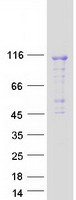 Coomassie blue staining of purified DENND1C protein (Cat# TP306410). The protein was produced from HEK293T cells transfected with DENND1C cDNA clone (Cat# RC206410) using MegaTran 2.0 (Cat# TT210002).
