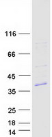 Coomassie blue staining of purified INKA2 protein (Cat# TP306467). The protein was produced from HEK293T cells transfected with INKA2 cDNA clone (Cat# RC206467) using MegaTran 2.0 (Cat# TT210002).
