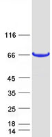 Coomassie blue staining of purified METTL25 protein (Cat# TP306658). The protein was produced from HEK293T cells transfected with METTL25 cDNA clone (Cat# RC206658) using MegaTran 2.0 (Cat# TT210002).