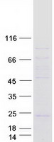 Coomassie blue staining of purified LOC541469 protein (Cat# TP306827). The protein was produced from HEK293T cells transfected with LOC541469 cDNA clone (Cat# RC206827) using MegaTran 2.0 (Cat# TT210002).