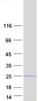 Coomassie blue staining of purified DUSP28 protein (Cat# TP306912). The protein was produced from HEK293T cells transfected with DUSP28 cDNA clone (Cat# RC206912) using MegaTran 2.0 (Cat# TT210002).