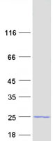 Coomassie blue staining of purified TMEM31 protein (Cat# TP306932). The protein was produced from HEK293T cells transfected with TMEM31 cDNA clone (Cat# RC206932) using MegaTran 2.0 (Cat# TT210002).
