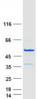 Coomassie blue staining of purified TEX9 protein (Cat# TP307059). The protein was produced from HEK293T cells transfected with TEX9 cDNA clone (Cat# RC207059) using MegaTran 2.0 (Cat# TT210002).