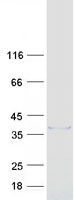 Coomassie blue staining of purified ZCCHC9 protein (Cat# TP307448). The protein was produced from HEK293T cells transfected with ZCCHC9 cDNA clone (Cat# RC207448) using MegaTran 2.0 (Cat# TT210002).
