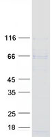 Coomassie blue staining of purified WDTC1 protein (Cat# TP307453). The protein was produced from HEK293T cells transfected with WDTC1 cDNA clone (Cat# RC207453) using MegaTran 2.0 (Cat# TT210002).