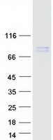 Coomassie blue staining of purified NDC80 protein (Cat# TP307565). The protein was produced from HEK293T cells transfected with NDC80 cDNA clone (Cat# RC207565) using MegaTran 2.0 (Cat# TT210002).