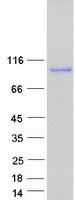 Coomassie blue staining of purified USO1 protein (Cat# TP307614). The protein was produced from HEK293T cells transfected with USO1 cDNA clone (Cat# RC207614) using MegaTran 2.0 (Cat# TT210002).