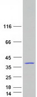 Coomassie blue staining of purified DNAJC8 protein (Cat# TP307697). The protein was produced from HEK293T cells transfected with DNAJC8 cDNA clone (Cat# RC207697) using MegaTran 2.0 (Cat# TT210002).
