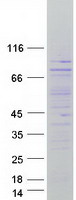 Coomassie blue staining of purified CTDSPL2 protein (Cat# TP307746). The protein was produced from HEK293T cells transfected with CTDSPL2 cDNA clone (Cat# RC207746) using MegaTran 2.0 (Cat# TT210002).