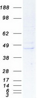 Coomassie blue staining of purified REM2 protein (Cat# TP307806). The protein was produced from HEK293T cells transfected with REM2 cDNA clone (Cat# RC207806) using MegaTran 2.0 (Cat# TT210002).