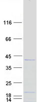 Coomassie blue staining of purified C1orf131 protein (Cat# TP307816). The protein was produced from HEK293T cells transfected with C1orf131 cDNA clone (Cat# RC207816) using MegaTran 2.0 (Cat# TT210002).