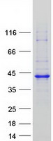 Coomassie blue staining of purified RP2 protein (Cat# TP308124). The protein was produced from HEK293T cells transfected with RP2 cDNA clone (Cat# RC208124) using MegaTran 2.0 (Cat# TT210002).