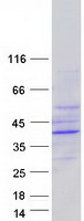 Coomassie blue staining of purified EPHX4 protein (Cat# TP308145). The protein was produced from HEK293T cells transfected with EPHX4 cDNA clone (Cat# RC208145) using MegaTran 2.0 (Cat# TT210002).