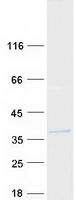 Coomassie blue staining of purified ARL14EP protein (Cat# TP308413). The protein was produced from HEK293T cells transfected with ARL14EP cDNA clone (Cat# RC208413) using MegaTran 2.0 (Cat# TT210002).