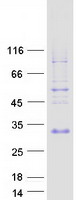 Coomassie blue staining of purified SPANXN3 protein (Cat# TP309390). The protein was produced from HEK293T cells transfected with SPANXN3 cDNA clone (Cat# RC209390) using MegaTran 2.0 (Cat# TT210002).