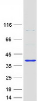 Coomassie blue staining of purified TYW3 protein (Cat# TP310021). The protein was produced from HEK293T cells transfected with TYW3 cDNA clone (Cat# RC210021) using MegaTran 2.0 (Cat# TT210002).