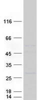 Coomassie blue staining of purified KLRA1 protein (Cat# TP310234). The protein was produced from HEK293T cells transfected with KLRA1 cDNA clone (Cat# RC210234) using MegaTran 2.0 (Cat# TT210002).