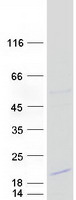 Coomassie blue staining of purified DSCR4 protein (Cat# TP310247). The protein was produced from HEK293T cells transfected with DSCR4 cDNA clone (Cat# RC210247) using MegaTran 2.0 (Cat# TT210002).