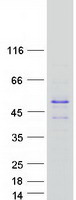 Coomassie blue staining of purified TSPY3 protein (Cat# TP310427). The protein was produced from HEK293T cells transfected with TSPY3 cDNA clone (Cat# RC210427) using MegaTran 2.0 (Cat# TT210002).