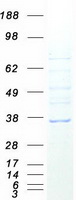 Coomassie blue staining of purified FAM92B protein (Cat# TP310788). The protein was produced from HEK293T cells transfected with FAM92B cDNA clone (Cat# RC210788) using MegaTran 2.0 (Cat# TT210002).