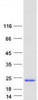 Coomassie blue staining of purified CYorf15A protein (Cat# TP311067). The protein was produced from HEK293T cells transfected with CYorf15A cDNA clone (Cat# RC211067) using MegaTran 2.0 (Cat# TT210002).