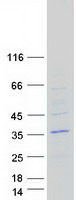 Coomassie blue staining of purified ODF4 protein (Cat# TP311295). The protein was produced from HEK293T cells transfected with ODF4 cDNA clone (Cat# RC211295) using MegaTran 2.0 (Cat# TT210002).