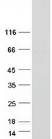 Coomassie blue staining of purified POC5 protein (Cat# TP311731). The protein was produced from HEK293T cells transfected with POC5 cDNA clone (Cat# RC211731) using MegaTran 2.0 (Cat# TT210002).