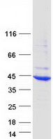 Coomassie blue staining of purified HYKK protein (Cat# TP312299). The protein was produced from HEK293T cells transfected with HYKK cDNA clone (Cat# RC212299) using MegaTran 2.0 (Cat# TT210002).