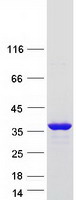 Coomassie blue staining of purified CCDC149 protein (Cat# TP312457). The protein was produced from HEK293T cells transfected with CCDC149 cDNA clone (Cat# RC212457) using MegaTran 2.0 (Cat# TT210002).