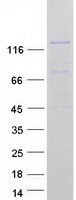 Coomassie blue staining of purified MCF2L2 protein (Cat# TP312640). The protein was produced from HEK293T cells transfected with MCF2L2 cDNA clone (Cat# RC212640) using MegaTran 2.0 (Cat# TT210002).