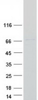 Coomassie blue staining of purified SYTL3 protein (Cat# TP312752). The protein was produced from HEK293T cells transfected with SYTL3 cDNA clone (Cat# RC212752) using MegaTran 2.0 (Cat# TT210002).