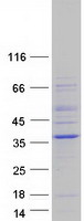 Coomassie blue staining of purified NEURL2 protein (Cat# TP312983). The protein was produced from HEK293T cells transfected with NEURL2 cDNA clone (Cat# RC212983) using MegaTran 2.0 (Cat# TT210002).