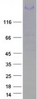 Coomassie blue staining of purified MEGF6 protein (Cat# TP313157). The protein was produced from HEK293T cells transfected with MEGF6 cDNA clone (Cat# RC213157) using MegaTran 2.0 (Cat# TT210002).