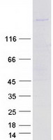 Coomassie blue staining of purified MYPN protein (Cat# TP313189). The protein was produced from HEK293T cells transfected with MYPN cDNA clone (Cat# RC213189) using MegaTran 2.0 (Cat# TT210002).